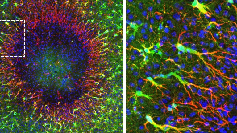 The image on the left shows a brain lesion (diameter: just under 0.5 mm). Around the perimeter of the lesion, the newly discovered “regenerative” astrocytes begin to seal the defect by forming long cellular extensions (shown in red). Newly formed cell nuclei (shown in blue) migrate along the cellular extensions toward the damaged area. Unaltered astrocytes (shown in green) surround the lesion area. The image on the right shows an enlargement of the marked area in the left image. (Image: Institute of Pharmacology and Toxicology, UZH)