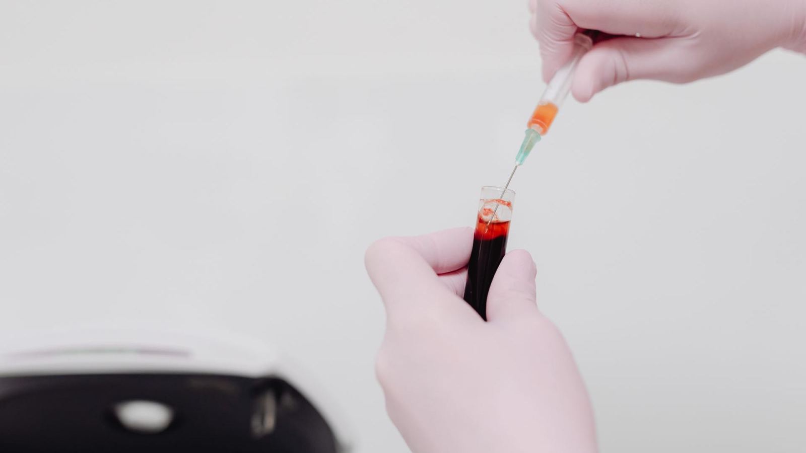 Lab technician using a syringe to handle a blood sample. Medical analysis concept.