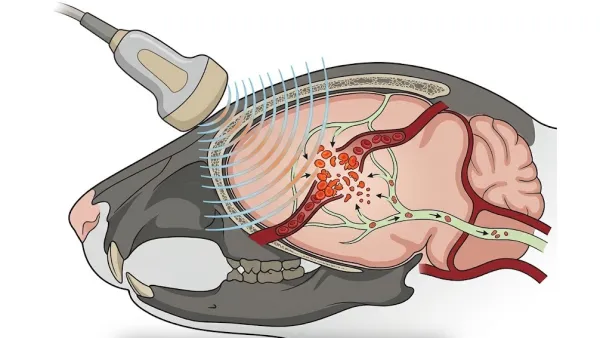 Ultrasound Flushed Blood Debris From Bleeding Mouse Brains