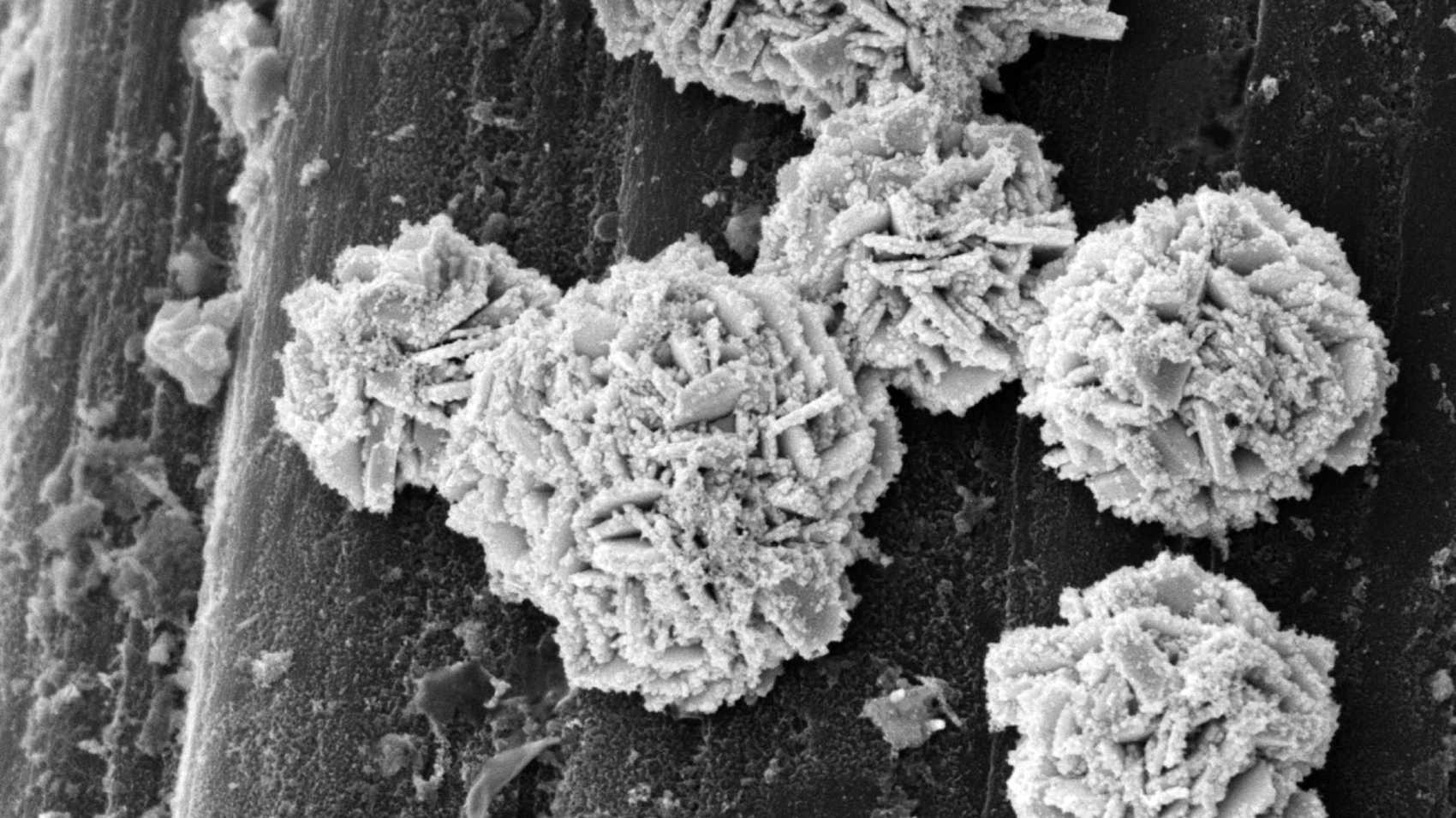 Electron microscopic image of the catalyst: The spherical structures resemble desert roses and consist of tiny gold platelets "dusted" with platinum particles. (Image: Debasis Maity, Biotechnology and Bioengineering Group / ETH Zurich)